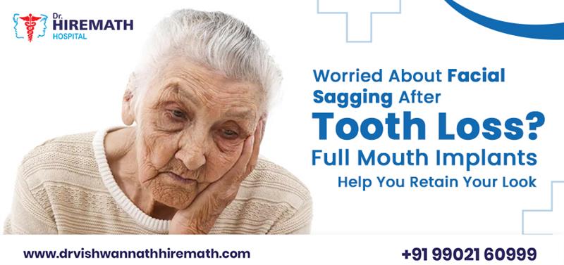 facial-sagging-after-tooth-loss-full-mouth-implants
